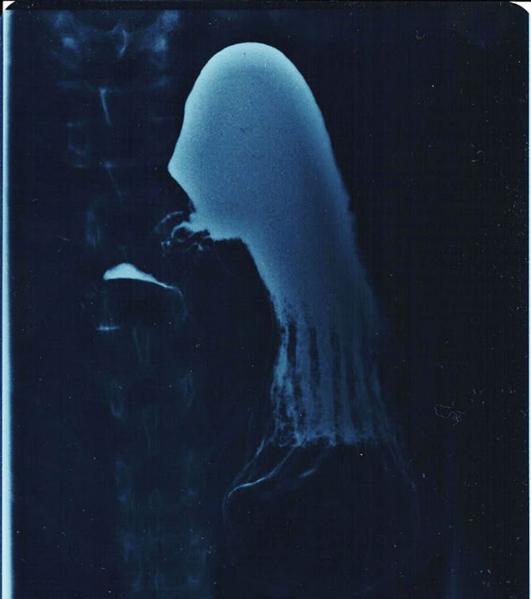 Visuals: Radiographs.